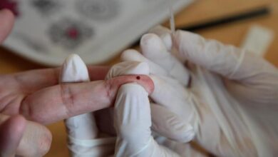 Photo of Santos faz testes rápidos para hepatite C; confira endereços | Mais Saúde